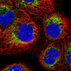 TMEM18 Antibody, Novus Biologicals 0.1mL; Unlabeled:Antibodies, Polyclonal